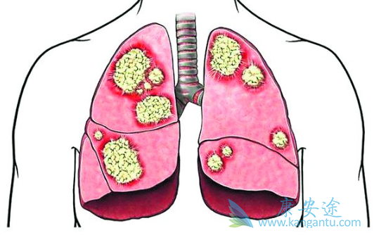 �ΰ��������κõ���