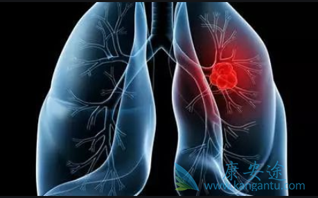 Сϸ���ΰ�������