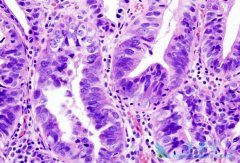 �ͷֻ��ٰ�������Чô