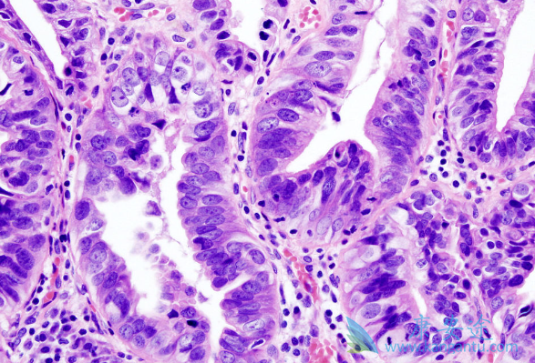 �ͷֻ��ٰ�������Чô