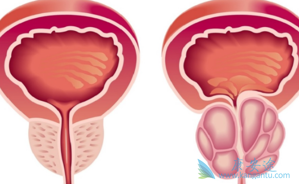 ǰ���ٰ���ת��