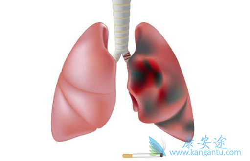 �ΰ�����֢״