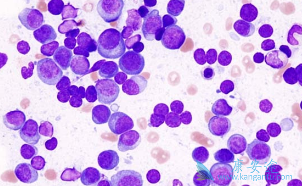 ���������κ���