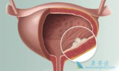 ���װ��׿��ҩ�������������Ч����Σ�