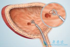 ���װ��Ĳ��򼰵���֢״