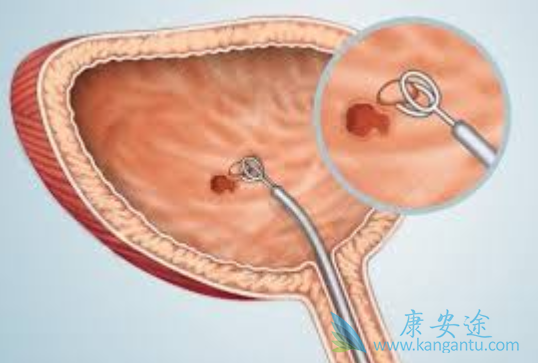 ���װ��Ĳ���