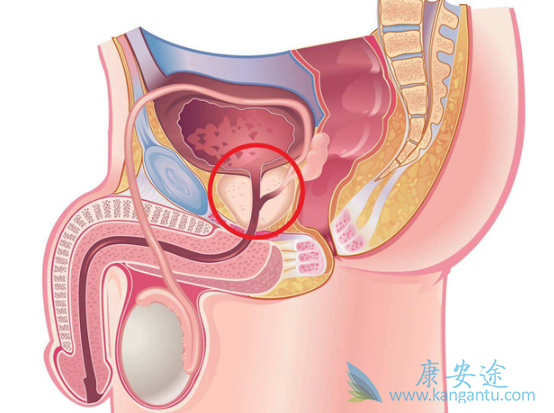 ǰ���ٰ�֢״