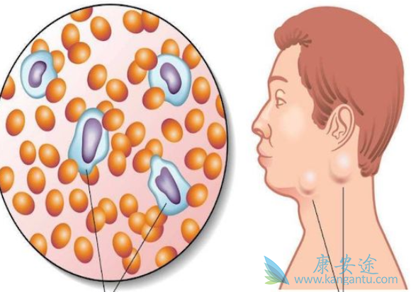 �ǻ�����ܰ���