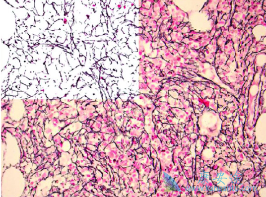 ������ά��