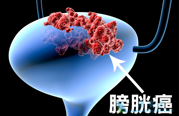 ���װ�������֢״