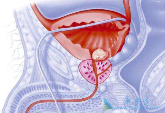 ǰ���ٰ�����