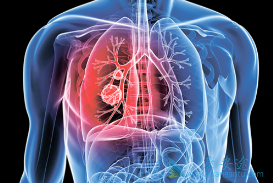 �ΰ����ڻ���