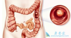 �᳦�������ܻ�����ʲô�йأ�