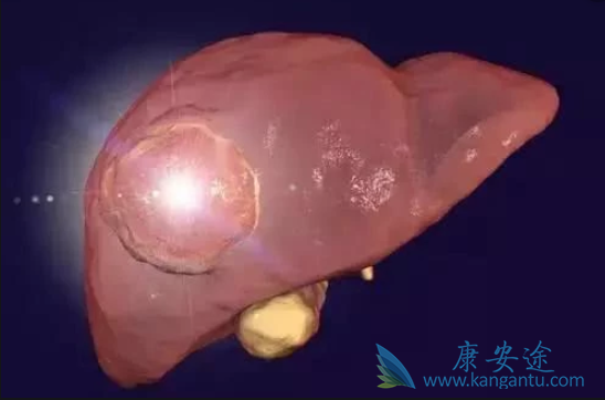 �ΰ���������