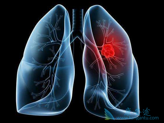 ��ɯ����