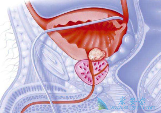 ǰ���ٰ��ܻ���