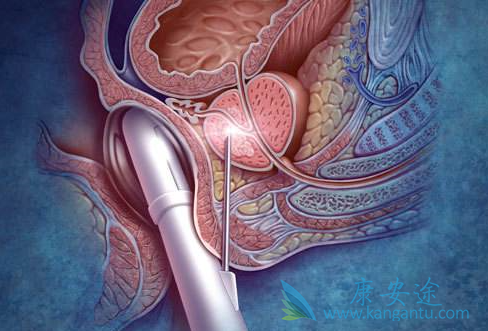 ǰ���ٰ�����