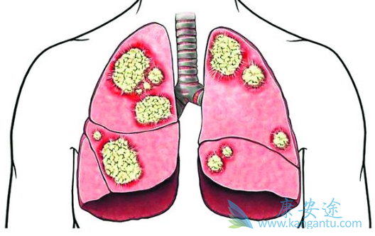 ���ڷΰ�����