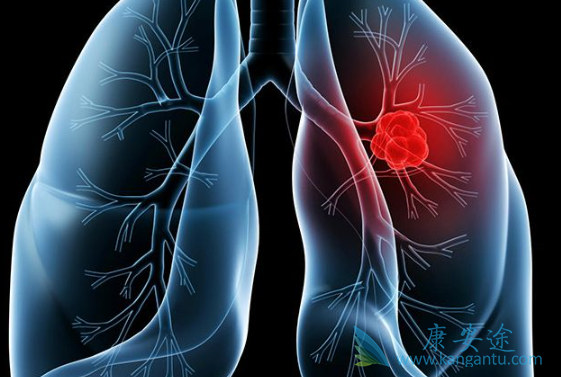 �ΰ���������