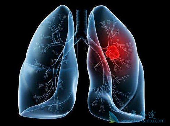 �ΰ�EGFR�е�