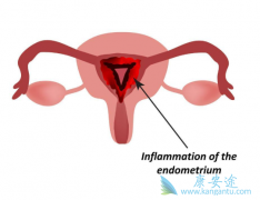 ���ѹܰ���֢״��������Щ��