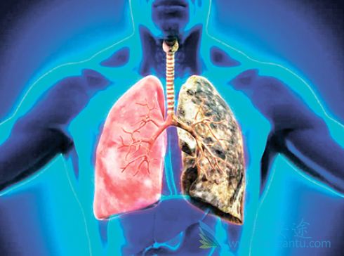 ���ڷΰ�����