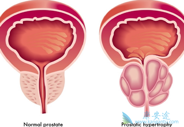 ǰ���ٰ�����