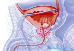 ���������ı���ǰ���ٰ����ƽ��