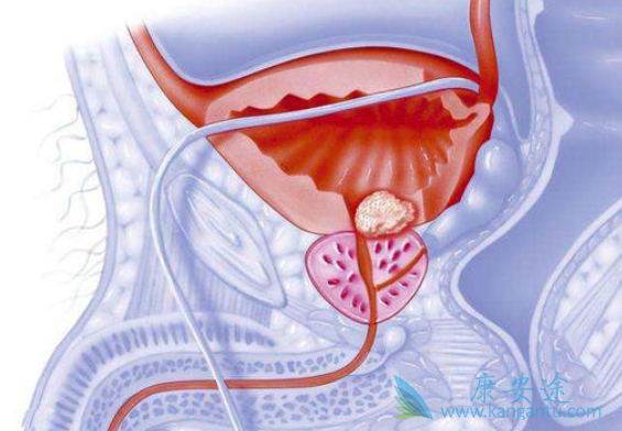 ǰ���ٰ�����