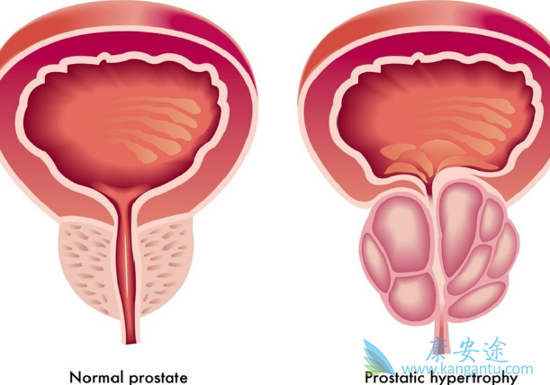 ǰ���ٰ�����