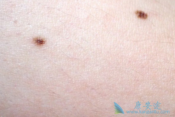 ��ɫ��������