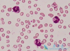 Ϊ�ι��������쳣�ۺ�֢�ֱ�������Ѫ��ǰ�ڣ�