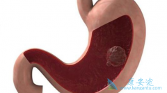 ����������Ϊθ�����������¸������Ƶ���Ч��Σ� 