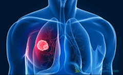 �ΰ��������Ʒ��������ѡ��