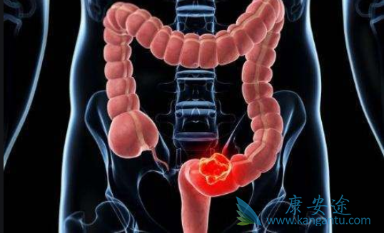 ��ֱ�������Ʒ���