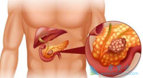 ���ٰ����Ʒ���