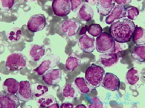 �������԰�Ѫ��