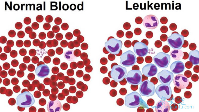 ��Ѫ��������