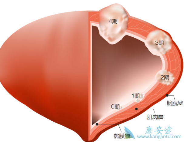 ���װ�������֢״