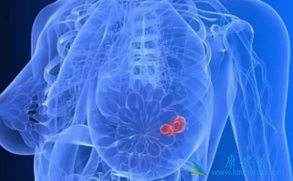 HER2阳性乳腺癌 HER2阳性乳腺癌