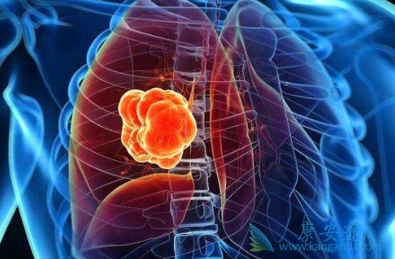 �ΰ��������κõ���