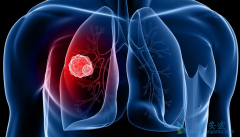 �ΰ�������֢״һ������Щ��