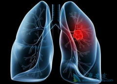 �ΰ��ٰ�������ѡ�������ƻ����������ƣ�