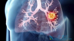 ���ڷΰ������ֶ�����Щ����Щҩ�ﱸ�ܻ��ߵĹ�ע��