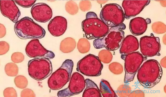 ������Ѫ����ʼ����������ǰҪ�˽������