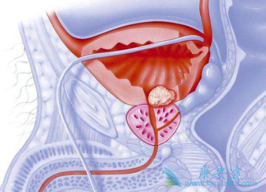 阿帕鲁胺 阿帕鲁胺