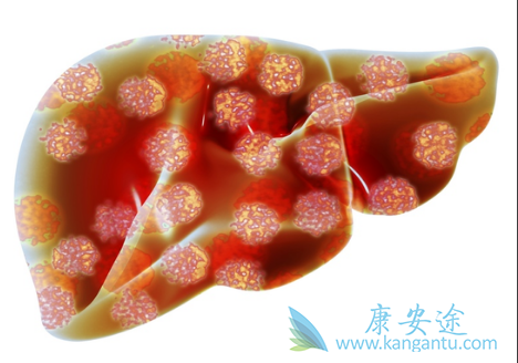 �ΰ�������֢״;�ΰ�����