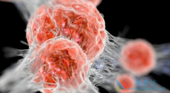 ��֢���κ������ư�֢����Щ�ֶΣ����ٰ�������