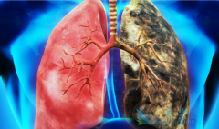 �ΰ���ת����ô���ƣ�����ӳ������ڣ�