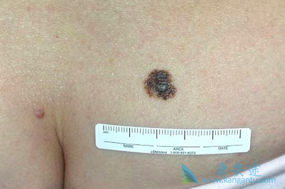 ��ɫ�������Ʒ���